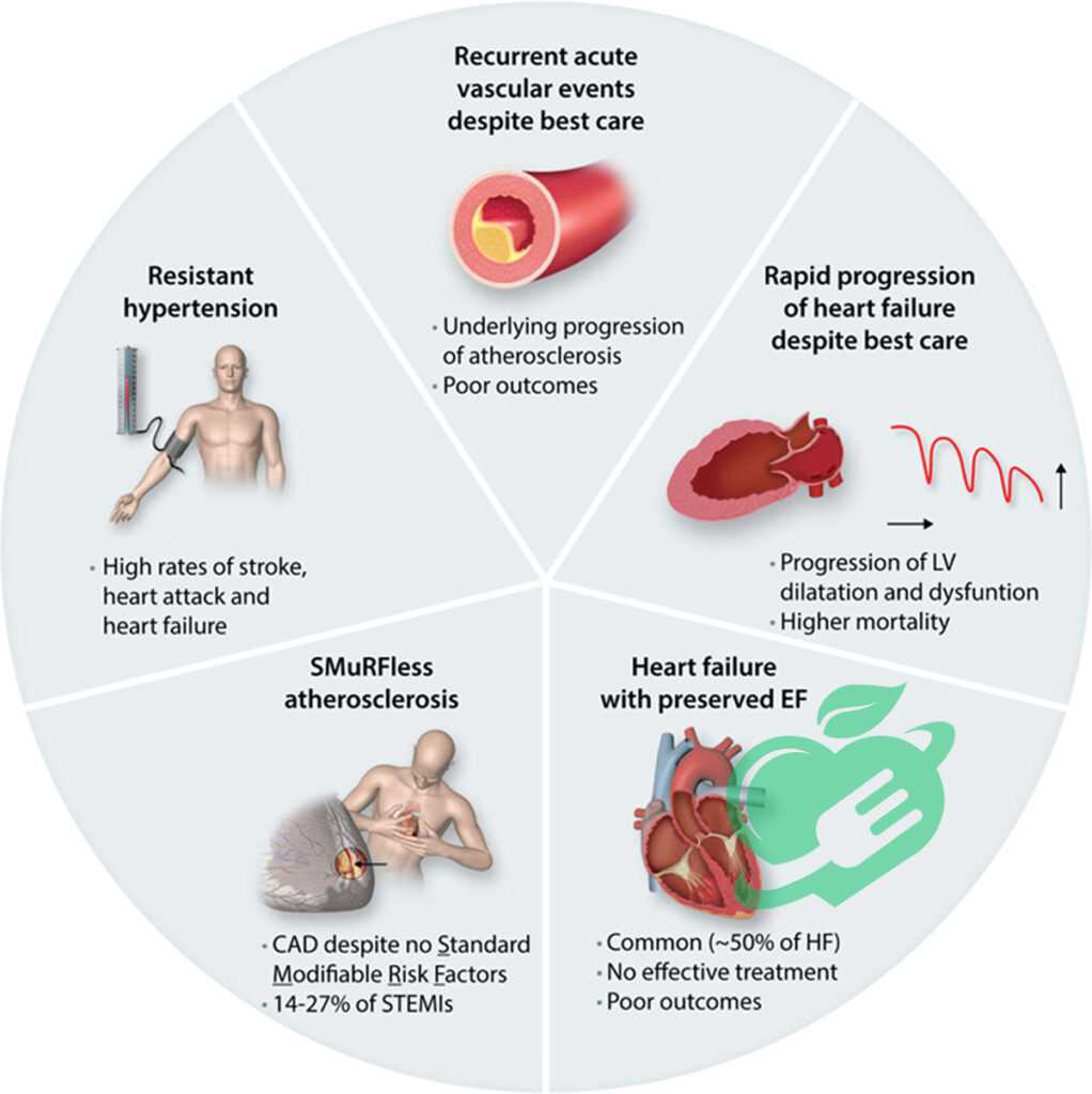 Angioplasty and Stent Placement