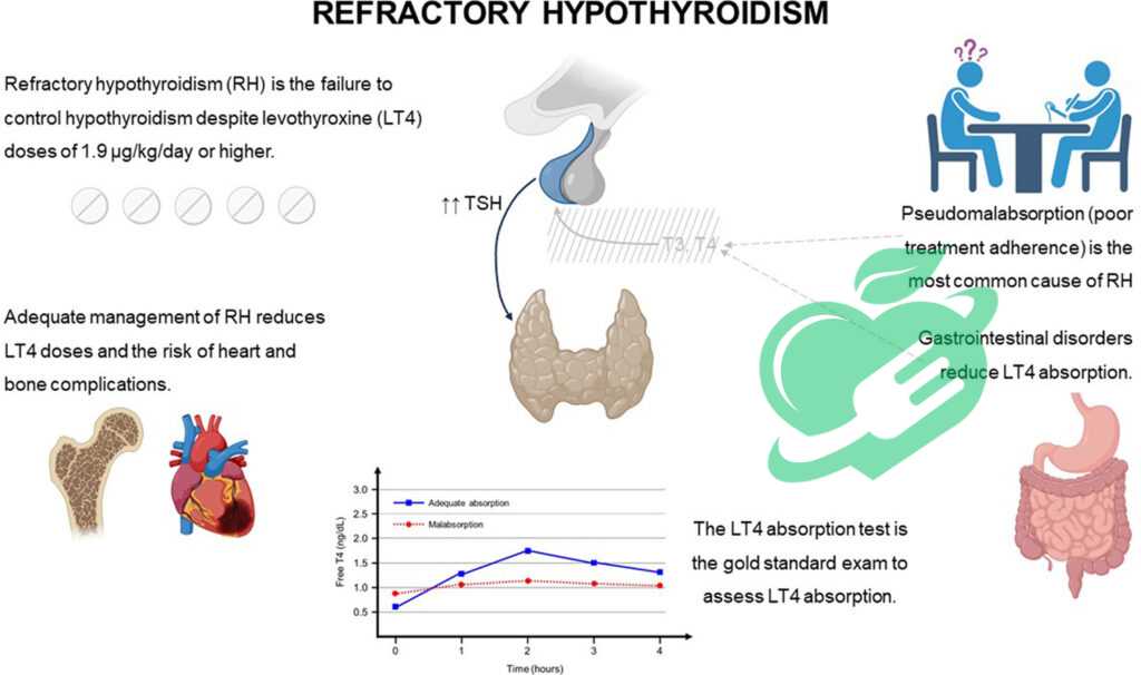 Future Directions in Hypothyroidism Treatment