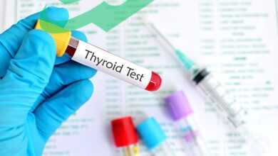 Hypothyroidism Treatments