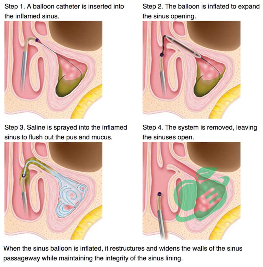 Pre-operative Instructions