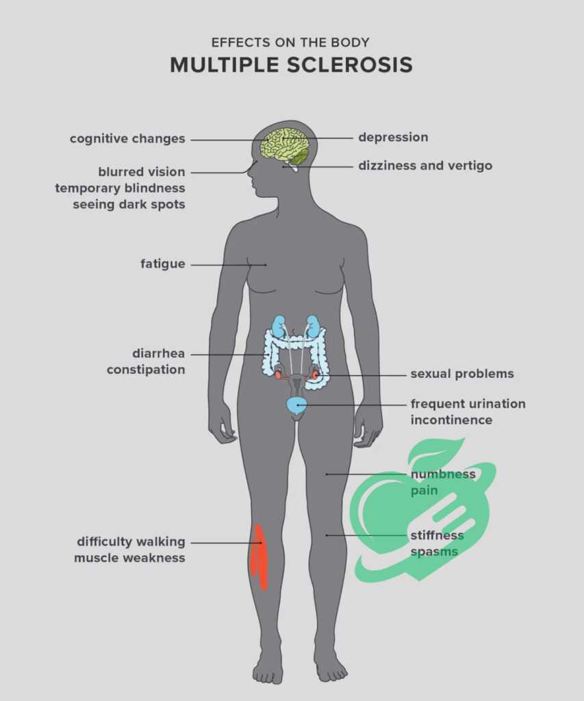 Relationship between MS and Headaches