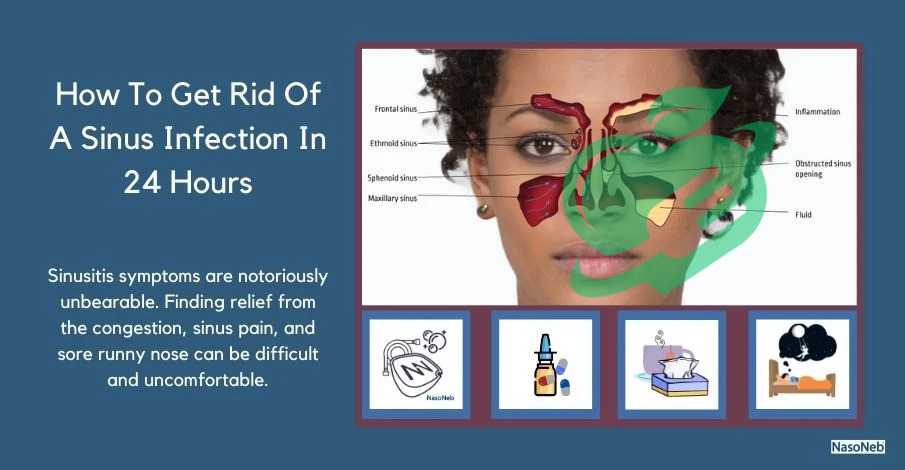 Symptoms of Sinus Headaches