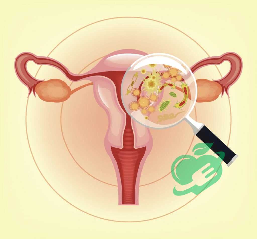 Trichomoniasis