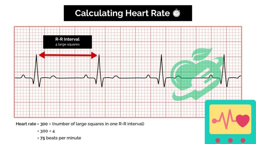 Calculating Heart Rate from ECG