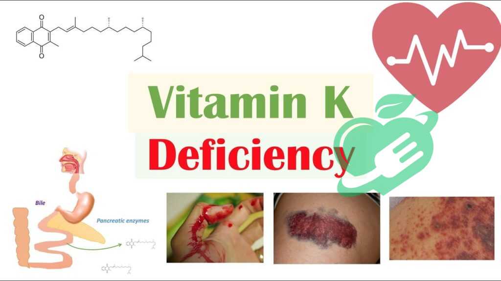 Impact of Deficiency on Overall Health