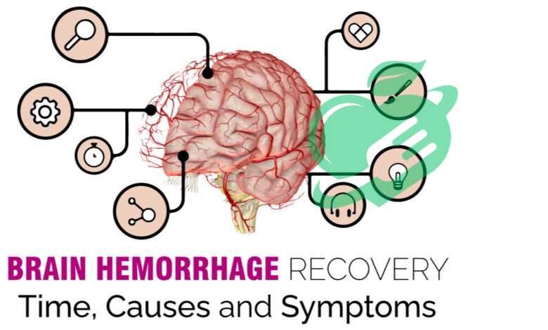 Preventing and Managing Brain Bleed What You Need to Know