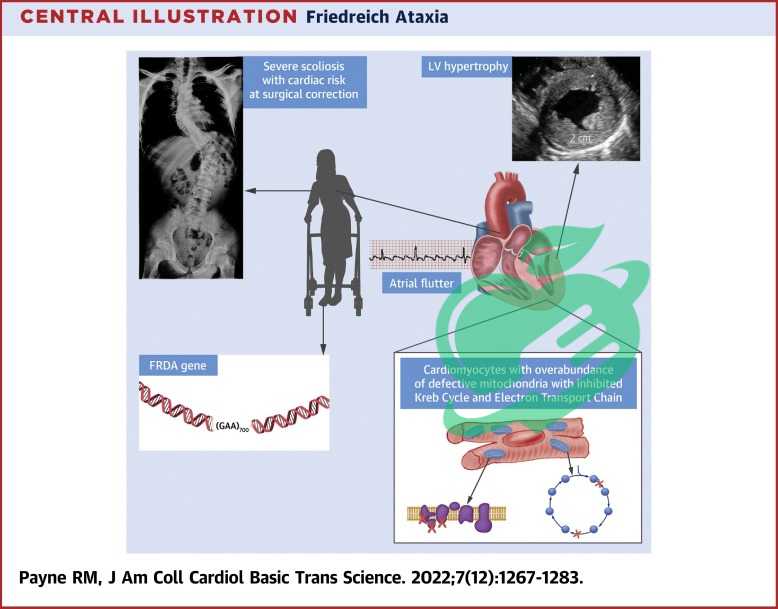 Current Treatment Approaches for Friedreich's Ataxia