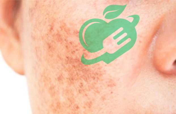 Home Remedies for Sunspots