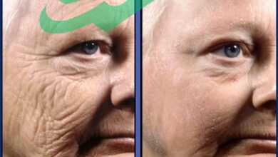 retinol before and after