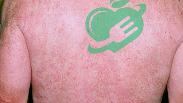 Causes of Red Man's Syndrome