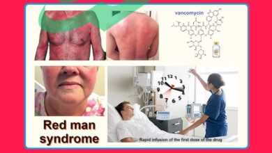 What is Red Man's Syndrome?